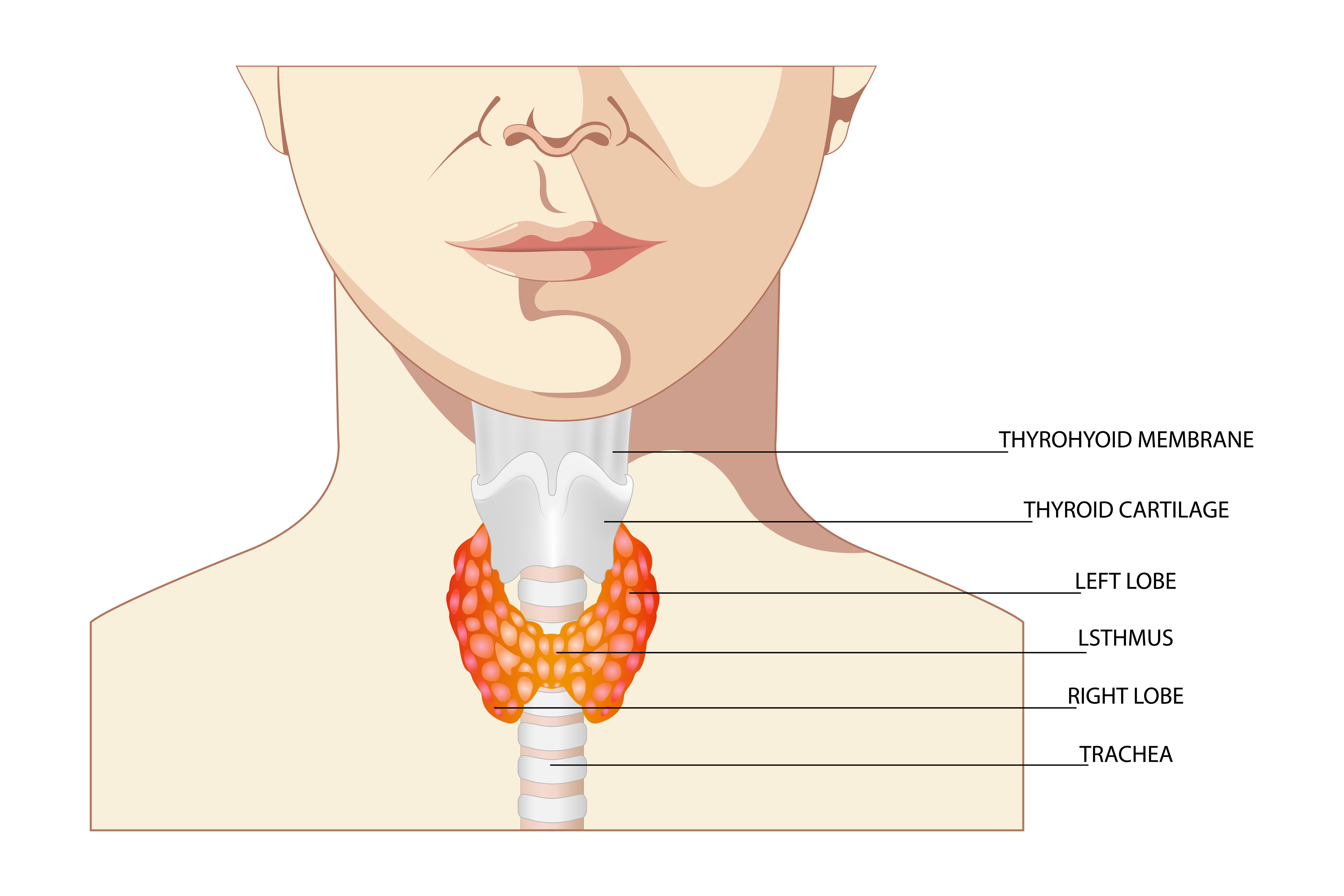 thyroid noule