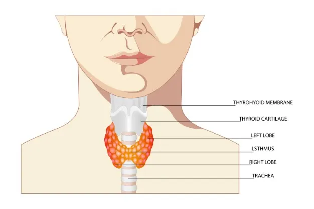 thyroid noule